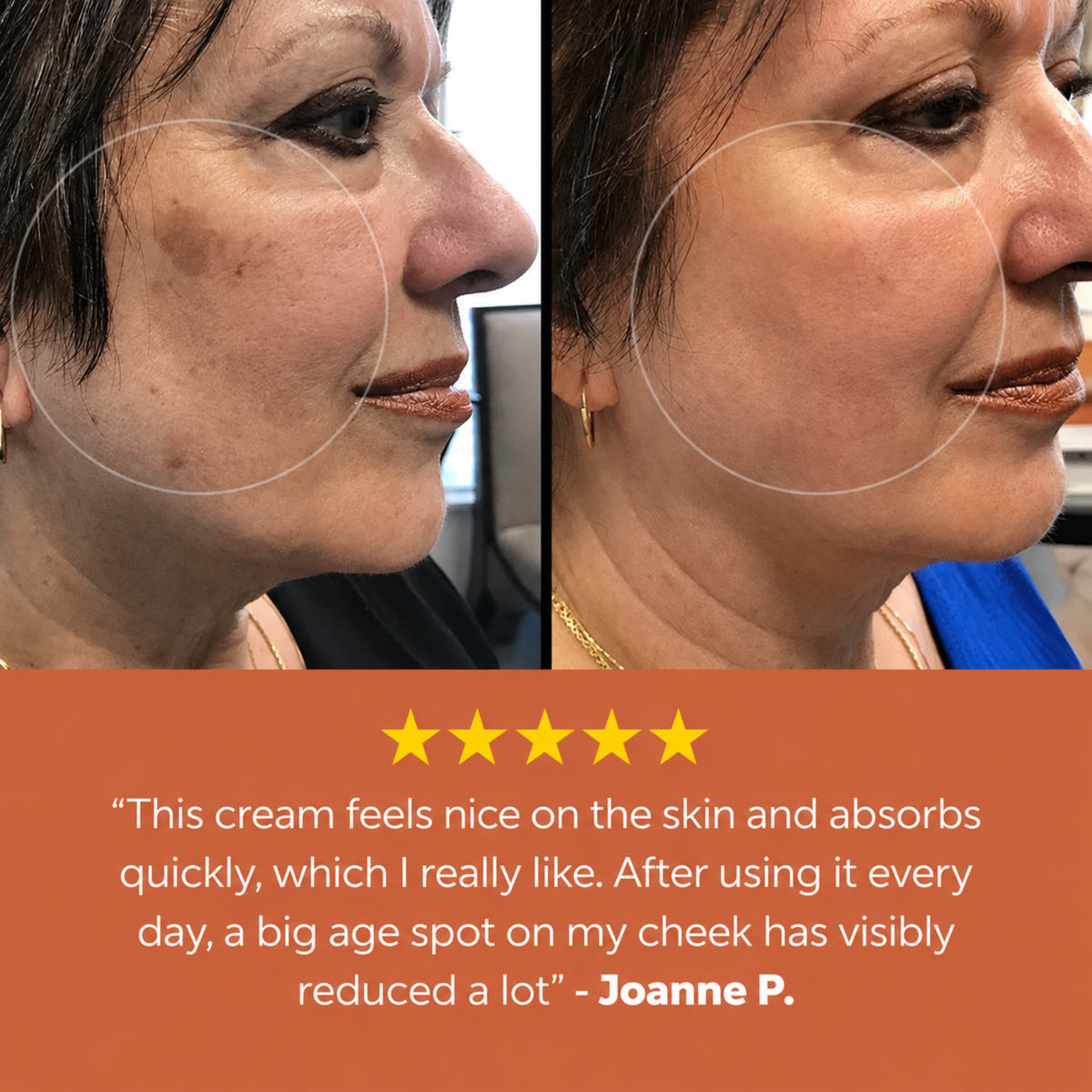 Sevorea™ Age Spot Cream
