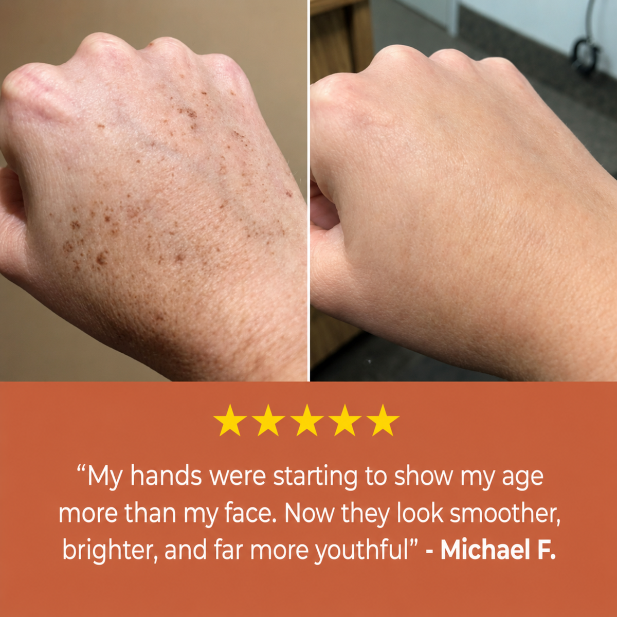 Sevorea™ Age Spot Cream